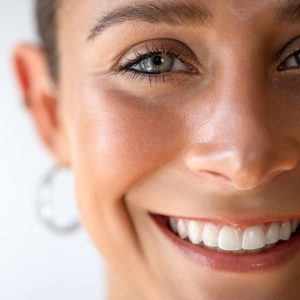 Láser CO2 fraccionado